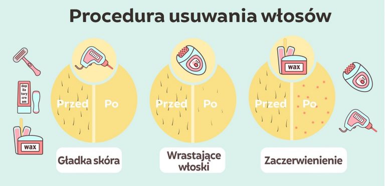 Gładkie ciało bez wrastających włosków, bez podrażnień! Czy to możliwe?