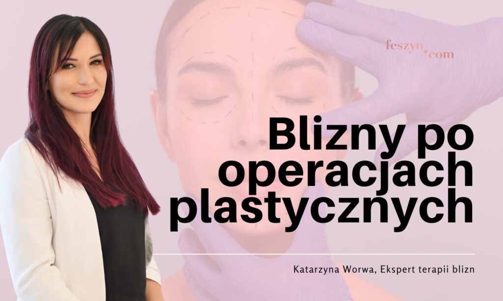 Blizny po operacjach plastycznych